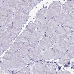 Invitrogen WDR35 Polyclonal Antibody 100 &mu;L; Unconjugated:Antibodies,