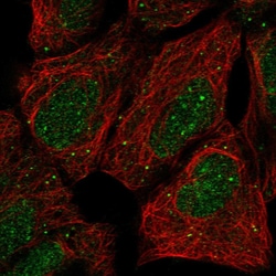 Invitrogen PRR22 Polyclonal Antibody 100 &mu;L; Unconjugated:Antibodies,