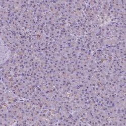 Invitrogen NHP2 Polyclonal Antibody 100 &mu;L | Buy Online | Invitrogen&trade; | Fisher Scientific