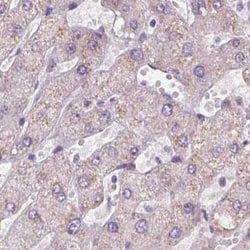 Invitrogen NHP2 Polyclonal Antibody 100 &mu;L | Buy Online | Invitrogen&trade; | Fisher Scientific