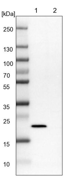 Invitrogen NHP2 Polyclonal Antibody 100 &mu;L | Buy Online | Invitrogen&trade; | Fisher Scientific