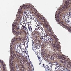 Invitrogen SDOS Polyclonal Antibody 100 &mu;L; Unconjugated:Antibodies,