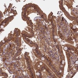 Invitrogen SDOS Polyclonal Antibody 100 &mu;L; Unconjugated:Antibodies,