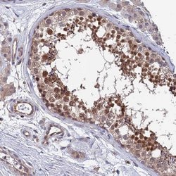 Invitrogen SDOS Polyclonal Antibody 100 &mu;L; Unconjugated:Antibodies,