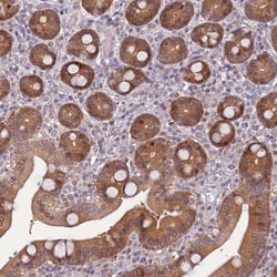 Invitrogen GEF5 Polyclonal Antibody 100 &mu;L; Unconjugated:Antibodies,