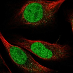 Invitrogen HDGFRP2 Polyclonal Antibody 100 &mu;L; Unconjugated:Antibodies,