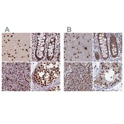 Invitrogen HDGFRP2 Polyclonal Antibody 100 &mu;L; Unconjugated:Antibodies,