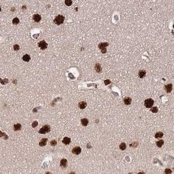 Invitrogen HDGFRP2 Polyclonal Antibody 100 &mu;L; Unconjugated:Antibodies,