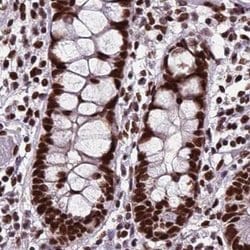 Invitrogen HDGFRP2 Polyclonal Antibody 100 &mu;L; Unconjugated:Antibodies,