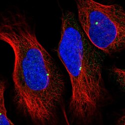 Invitrogen MKKS Polyclonal Antibody 100 &mu;L; Unconjugated:Antibodies,