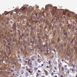 Invitrogen MKKS Polyclonal Antibody 100 &mu;L; Unconjugated:Antibodies,
