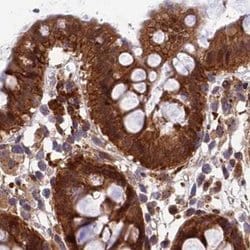 Invitrogen MKKS Polyclonal Antibody 100 &mu;L; Unconjugated:Antibodies,