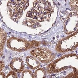 Invitrogen MKKS Polyclonal Antibody 100 &mu;L; Unconjugated:Antibodies,