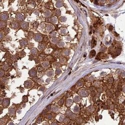 Invitrogen MKKS Polyclonal Antibody 100 &mu;L; Unconjugated:Antibodies,