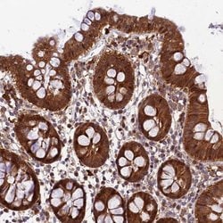 Invitrogen MKKS Polyclonal Antibody 100 &mu;L; Unconjugated:Antibodies,