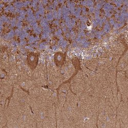 SNRNP25 Polyclonal Antibody:Antibodies, Polyclonal