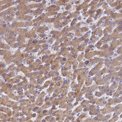 LBX2 Polyclonal Antibody 100 &mu;L | Buy Online | Thermo Scientific | Fisher Scientific