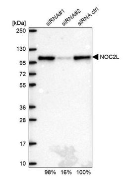 Invitrogen NOC2L Polyclonal Antibody 100 &mu;L | Buy Online | Invitrogen&trade; | Fisher Scientific