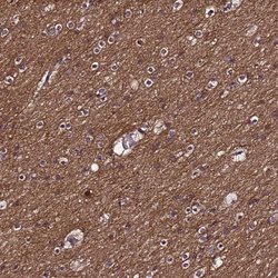 Invitrogen NELF Polyclonal Antibody 100 &mu;L; Unconjugated:Antibodies,
