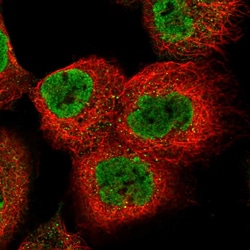 Invitrogen AMPK beta-2 Polyclonal Antibody 100 &mu;L; Unconjugated:Antibodies,