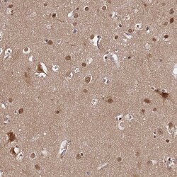 Invitrogen AMPK beta-2 Polyclonal Antibody 100 &mu;L; Unconjugated:Antibodies,