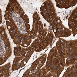 Invitrogen AMPK beta-2 Polyclonal Antibody 100 &mu;L; Unconjugated:Antibodies,