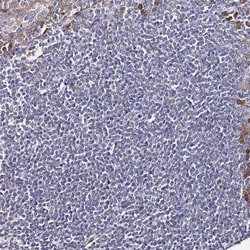 Invitrogen AMPK beta-2 Polyclonal Antibody 100 &mu;L; Unconjugated:Antibodies,