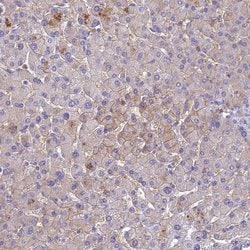 Invitrogen SLC13A5 Polyclonal Antibody 100 &mu;L | Buy Online | Invitrogen&trade; | Fisher Scientific