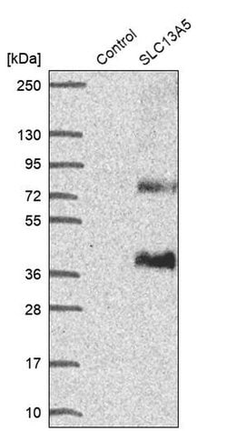 Invitrogen SLC13A5 Polyclonal Antibody 100 &mu;L | Buy Online | Invitrogen&trade; | Fisher Scientific