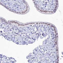 Invitrogen DHX40 Polyclonal Antibody 100 &mu;L; Unconjugated:Antibodies,
