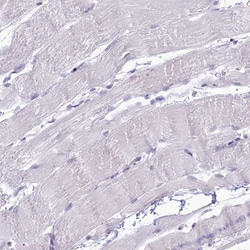Invitrogen DHX40 Polyclonal Antibody 100 &mu;L; Unconjugated:Antibodies,