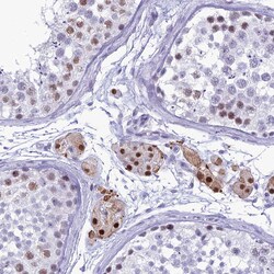 Invitrogen DHX40 Polyclonal Antibody 100 &mu;L; Unconjugated:Antibodies,