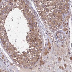 Invitrogen INCA1 Polyclonal Antibody 100 &mu;L; Unconjugated:Antibodies,