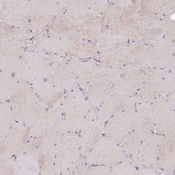 Invitrogen USP32 Polyclonal Antibody 100 &mu;L | Buy Online | Invitrogen&trade; | Fisher Scientific