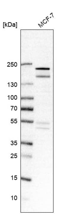 Invitrogen USP32 Polyclonal Antibody 100 &mu;L | Buy Online | Invitrogen&trade; | Fisher Scientific