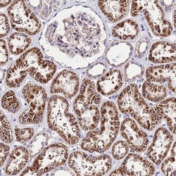 Invitrogen LACTB2 Polyclonal Antibody 100 &mu;L; Unconjugated:Antibodies,