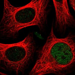 Invitrogen CASD1 Polyclonal Antibody 100 &mu;L; Unconjugated:Antibodies,