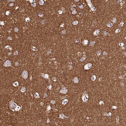 Invitrogen CASD1 Polyclonal Antibody 100 &mu;L; Unconjugated:Antibodies,