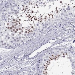 Invitrogen C17orf64 Polyclonal Antibody 100 &mu;L; Unconjugated:Antibodies,