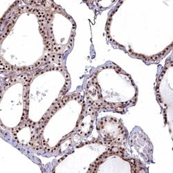 Invitrogen MAK16 Polyclonal Antibody 100 &mu;L; Unconjugated:Antibodies,