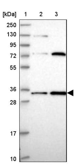 Invitrogen MRPL15 Polyclonal Antibody 100 &mu;L; Unconjugated:Antibodies,
