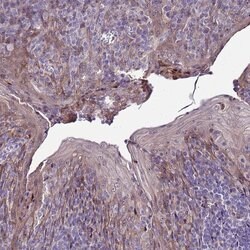 Invitrogen NOL8 Polyclonal Antibody 100 &mu;L; Unconjugated:Antibodies,