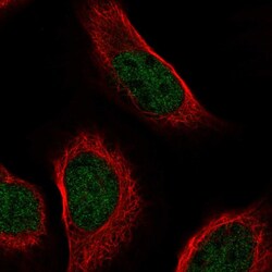 Invitrogen ZNF628 Polyclonal Antibody 100 &mu;L; Unconjugated:Antibodies,