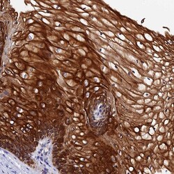 Invitrogen ZNF628 Polyclonal Antibody 100 &mu;L; Unconjugated:Antibodies,