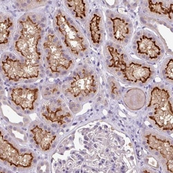 Invitrogen TMEM62 Polyclonal Antibody 100 &mu;L; Unconjugated:Antibodies,