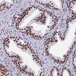 Invitrogen ZNF280A Polyclonal Antibody 100 &mu;L; Unconjugated:Antibodies,