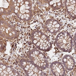 Invitrogen SDCCAG8 Polyclonal Antibody 100 &mu;L; Unconjugated:Antibodies,