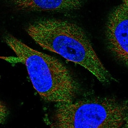 Invitrogen METTL13 Polyclonal Antibody 100 &mu;L; Unconjugated:Antibodies,