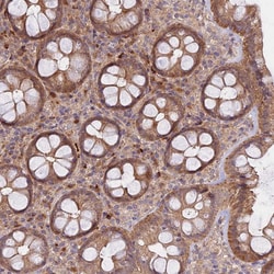 Invitrogen METTL13 Polyclonal Antibody 100 &mu;L; Unconjugated:Antibodies,