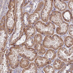 Invitrogen GPR113 Polyclonal Antibody 100 &mu;L | Buy Online | Invitrogen&trade; | Fisher Scientific